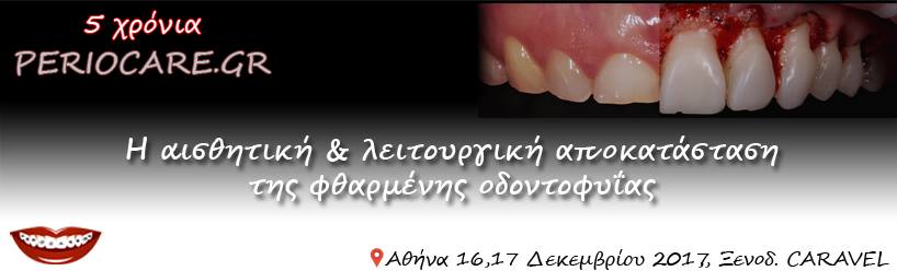 Η αποκατάσταση της φθαρμένης οδοντοφυΐας - Omnipress