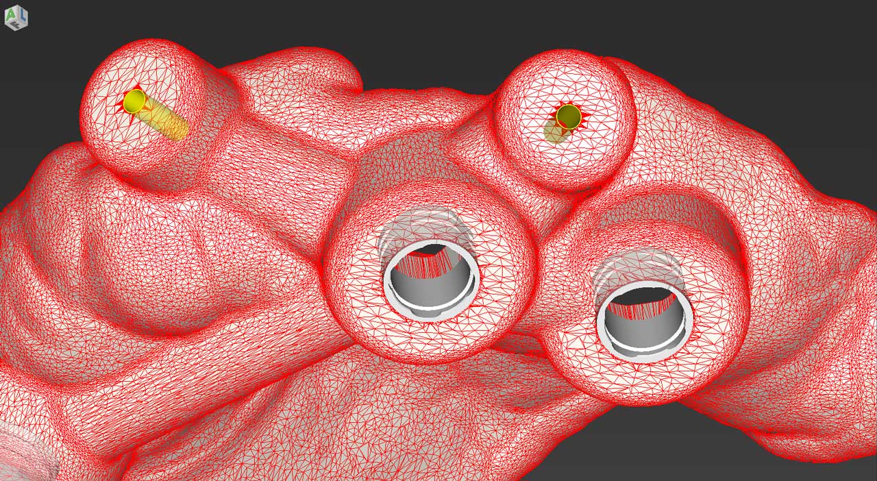 Ψηφιακή Εμφυτευματολογία Μέρος 1o - ΧΕΙΡΟΥΡΓΙΚΗ - Ασφάλεια & Προβλεψιμότητα στην Εμφυτευματολογία