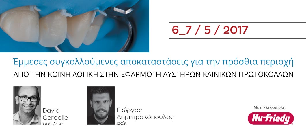 Έμμεσες συγκολούμενες αποκαταστάσεις για την πρόσθια περιοχή - Omnipress