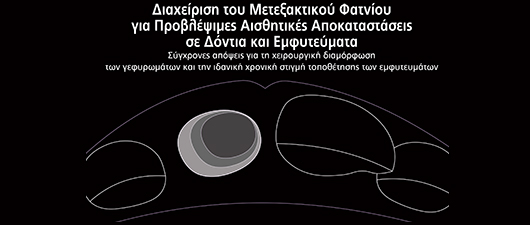 Διαχείριση του Μετεξακτικού Φατνίου για Προβλέψιμες Αισθητικές Αποκαταστάσεις σε Δόντια και Εμφυτεύματα. (Σύγχρονες απόψεις για τη χειρουργική διαμόρφωση των γεφυρωμάτων και την ιδανική χρονική στιγμή τοποθέτησης των εμφυτευμάτων) - Omnipress