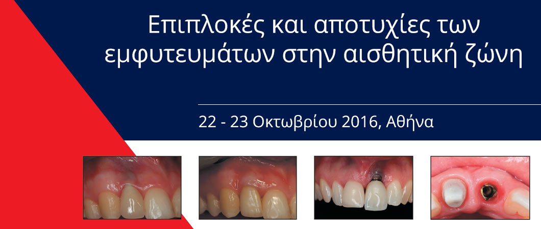 Επιπλοκές και αποτυχίες των εμφυτευμάτων στην αισθητική ζώνη - Omnipress