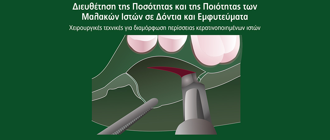 Διευθέτηση της Ποσότητας και της Ποιότητας των Μαλακών Ιστών σε Δόντια και Εμφυτεύματα (Χειρουργικές τεχνικές για διαμόρφωση περίσσειας κερατινοποιημένων ιστών) - Omnipress