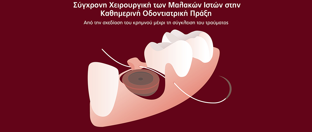 Σύγχρονη Χειρουργική των Μαλακών Ιστών στην Καθημερινή Οδοντιατρική Πράξη - Omnipress