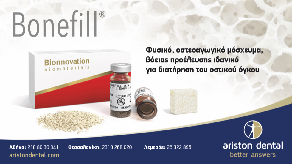 Διατήρηση του οστικού όγκου; Bonefill βόειο μόσχευμα!