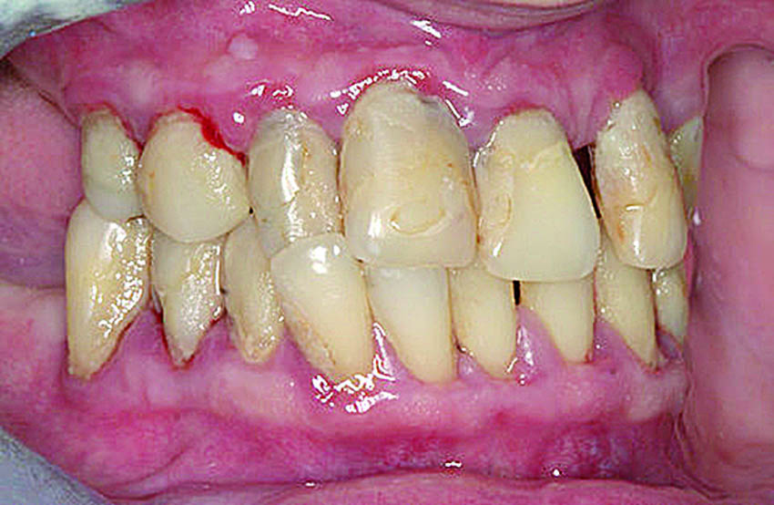 Αρχική κατάσταση