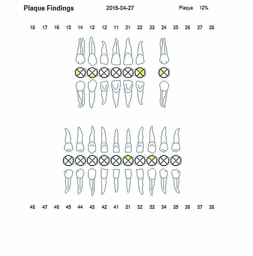 Δείκτης πλάκας