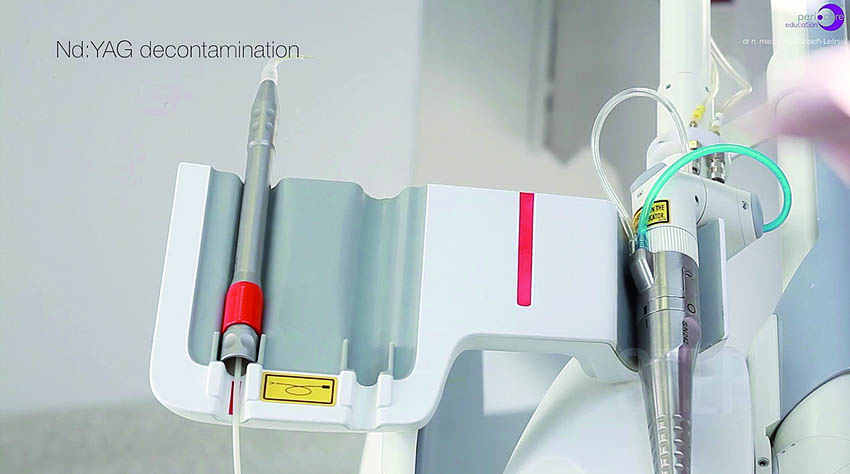 Αποστείρωση και απολύμανση των περιοδοντικών θυλάκων