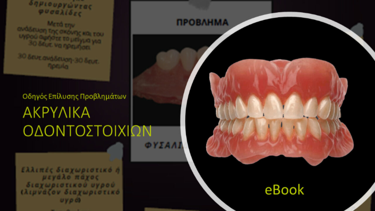 Οδηγός επίλυσης προβλημάτων σε ακρυλικά οδοντοστοιχιών από την Kulzer!
