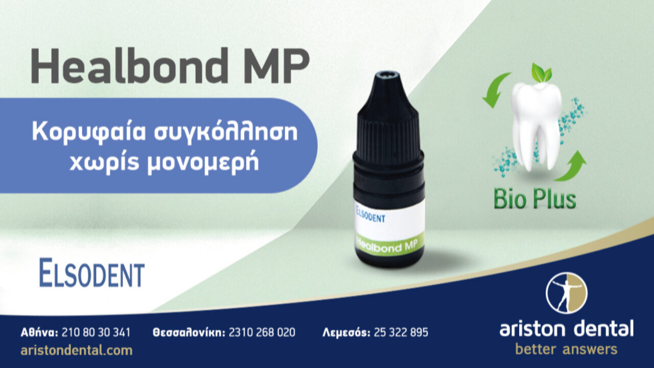 Κορυφαία συγκόλληση χωρίς μονομερή