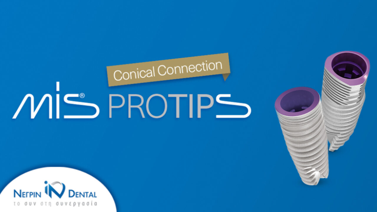 Κωνικά Εμφυτεύματα MIS: Τι έχουν να πουν οι ειδικοί;