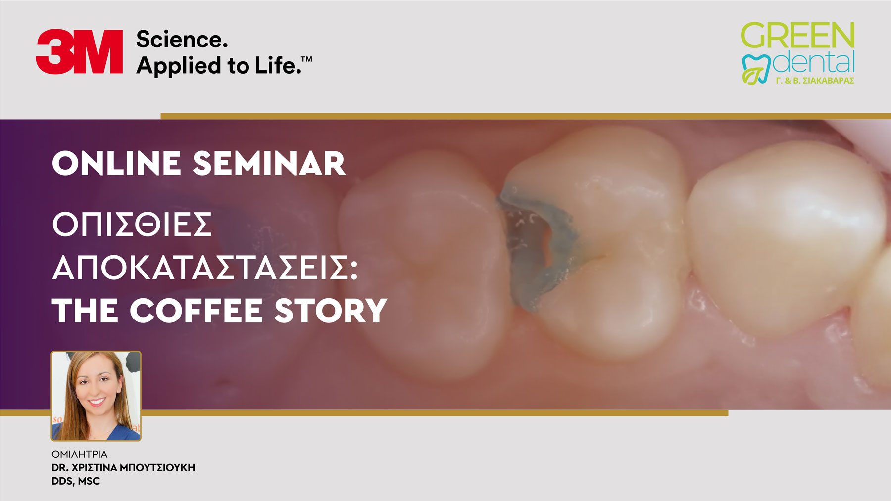 Οπίσθιες Αποκαταστάσεις: The Coffee Story