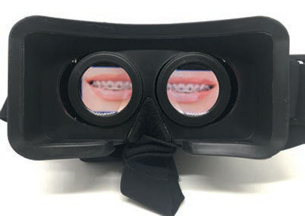 Εικ. 2.  Συσκευή κεφαλής για ΕΠ.