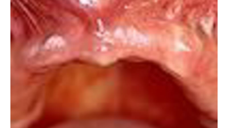 Edentulous Patient 12 Lecture Certificate Series