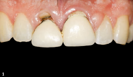 Μελέτη περίπτωσης