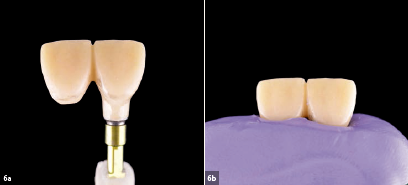 Προσθετική φάση