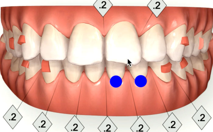 Minimally Invasive Aesthetic Dentistry & Invisalign