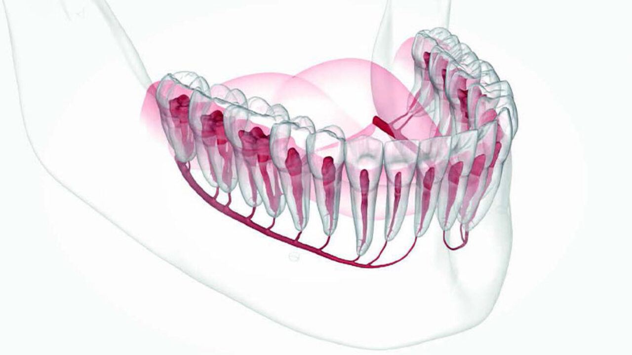 Η τεχνητή νοημοσύνη μπορεί να βοηθήσει στη χειρουργική των οδοντικών εμφυτευμάτων, εντοπίζοντας τον πόρο του κάτω φατνιακού νεύρου
