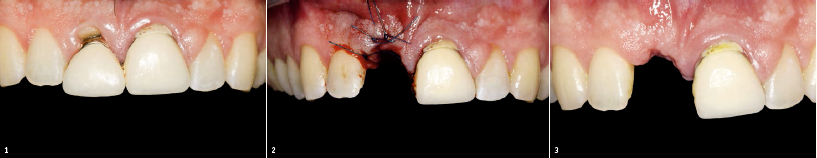 Συμπεράσματα