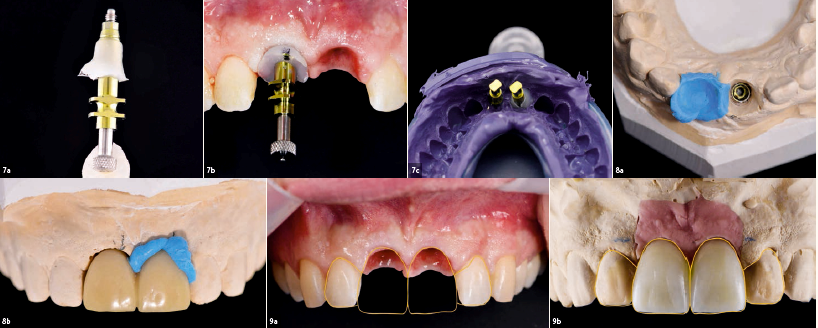 Συμπεράσματα