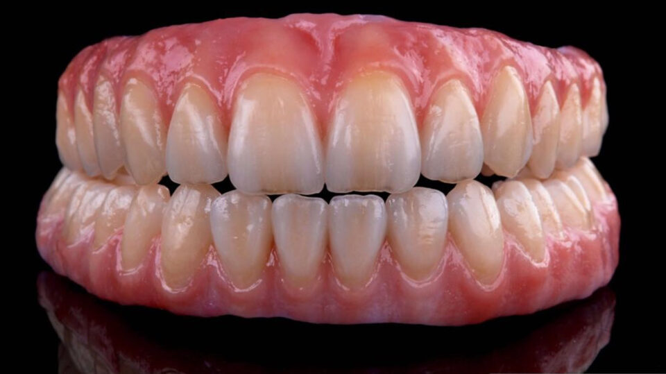 Implant Prosthodontics – From Single to Fully Edentulous Solutions