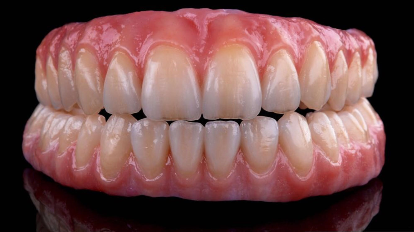Implant Prosthodontics – From Single to Fully Edentulous Solutions