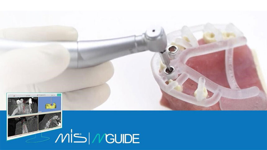 Kατευθυνόμενη τοποθέτηση εμφυτευμάτων: Νάρθηκας MIS Mguide, Χειρουργικές κασετίνες MGuide