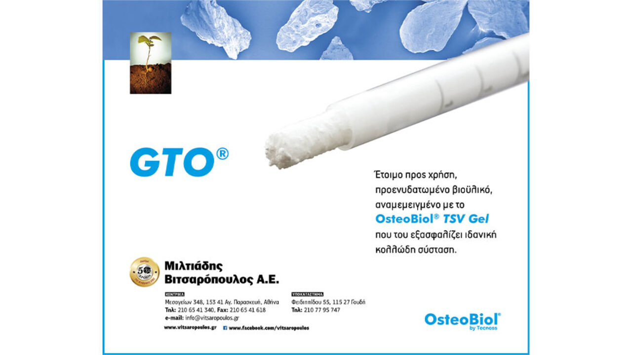 Έτοιμο προς χρήση, προενυδατωμένο οστικό μόσχευμα, με ιδανική κολλώδη σύσταση.