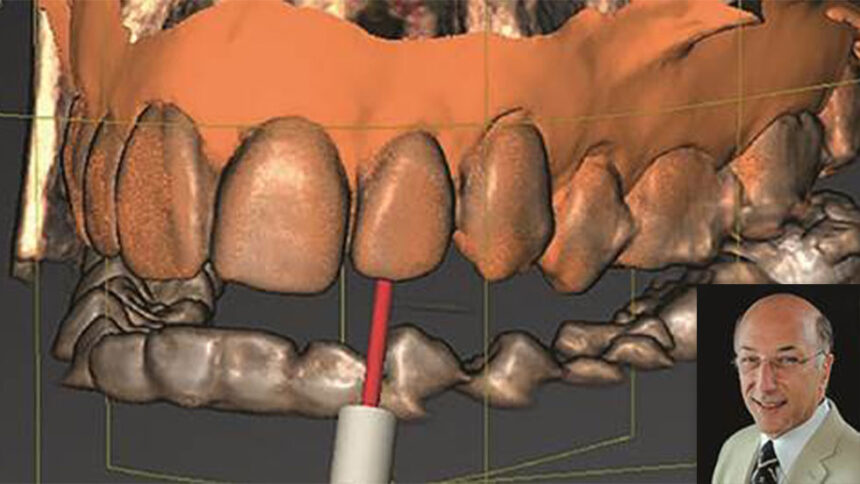 Ενασβεστιωμένοι ριζικοί σωλήνες. Μία νέα προσέγγιση σε ένα παλιό πρόβλημα.