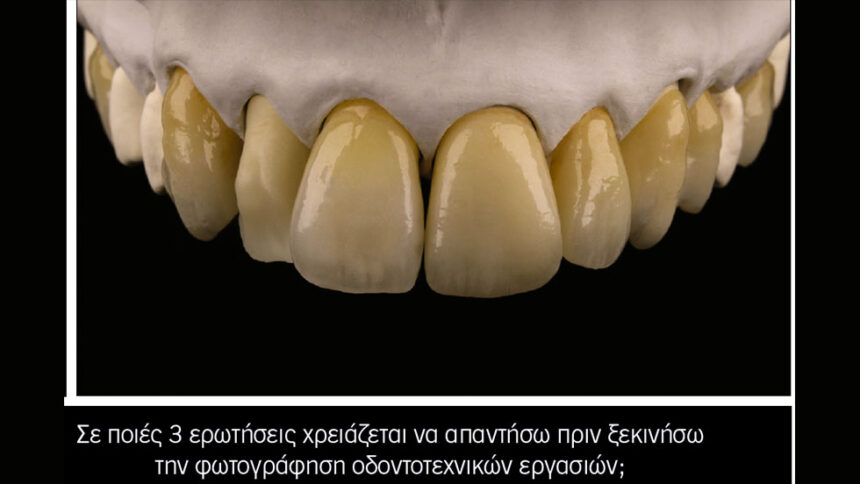 Φωτογραφίζω τις οδοντοτεχνικές εργασίες μου