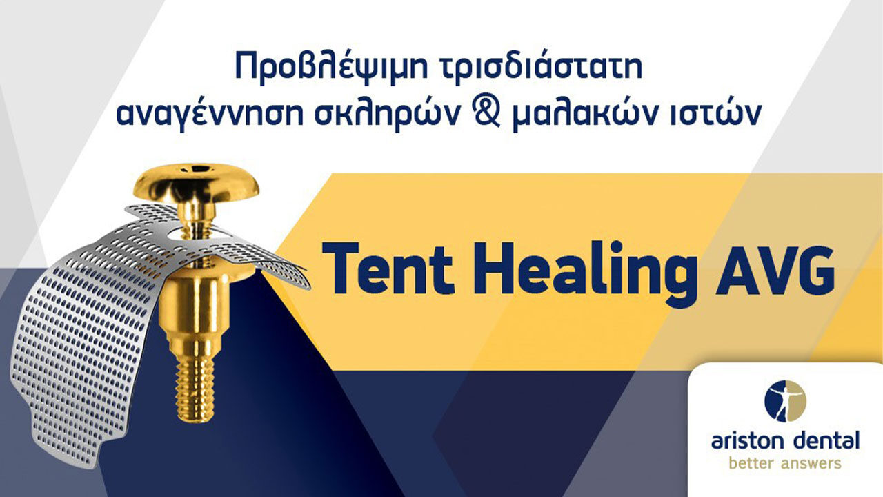 TENT HEALING AVG: To Nέο abutment για την τρισδιάστατη αναγέννηση σκληρών και μαλακών ιστών, από την Ariston Dental
