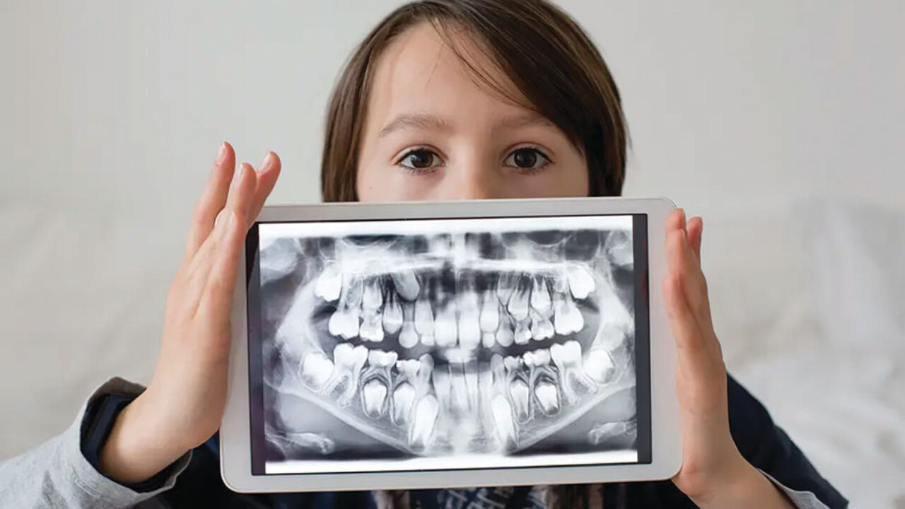 Ασύρματος αισθητήρας ακτινογραφιών με πολλές δυνατότητες