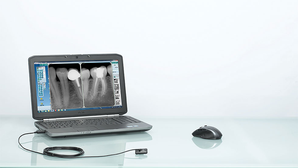 Ψηφιακή ακτινογραφία με σένσορα Opteo