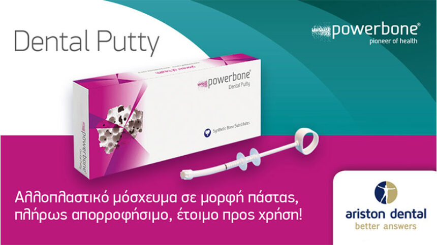 Powerbone Dental Putty - Αλλοπλαστικό μόσχευμα σε μορφή πάστας, έτοιμο προς χρήση!