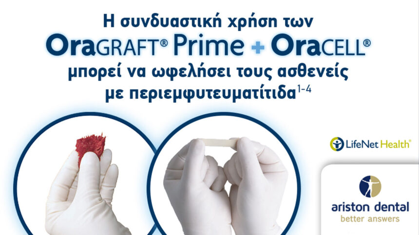 ARISTON DENTAL: Συνδυασμός OraGraft Prime & OraCELL για μέγιστη αποτελεσματικότητα κατά της περιεμφυτευματίτιδας!