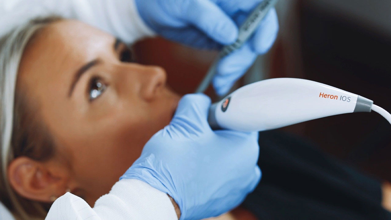 Ενδοστοματικός σαρωτής Heron IOS - Μια αρίστη προσθήκη σε κάθε σύγχρονο οδοντιατρείο | ΝΕΓΡΙΝ ΙΝ DENTAL