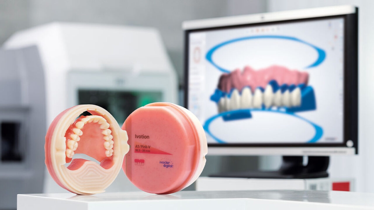 Το Σύστημα Οδοντοστοιχιών Ivotion Denture System φέρνει επανάσταση στην παραγωγή των κινητών προσθετικών αποκαταστάσεων