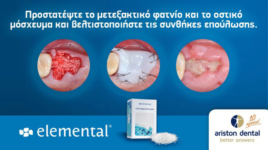 Εlemental - Προστατέψτε το μετεξακτικό φατνίο και το οστικό μόσχευμα και βελτιστοποιήστε τις συνθήκες επούλωσης.