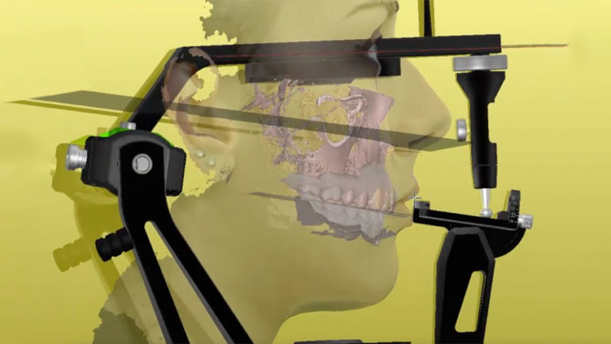 Προσθετικές στρατηγικές σε αποκαταστάσεις στηριζόμενες σε φυσικά δόντια - Εκπαιδευτής: Giacomo Fabbri