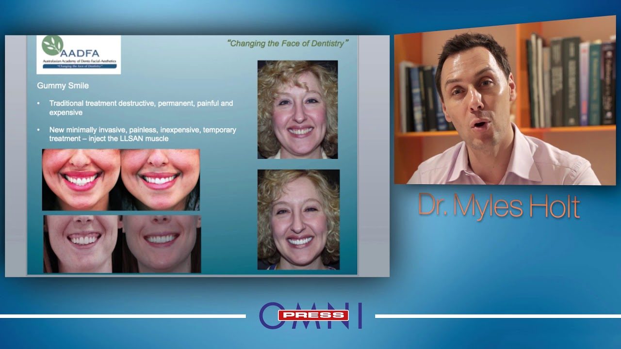 Botox & Derma Fillers in Dentistry