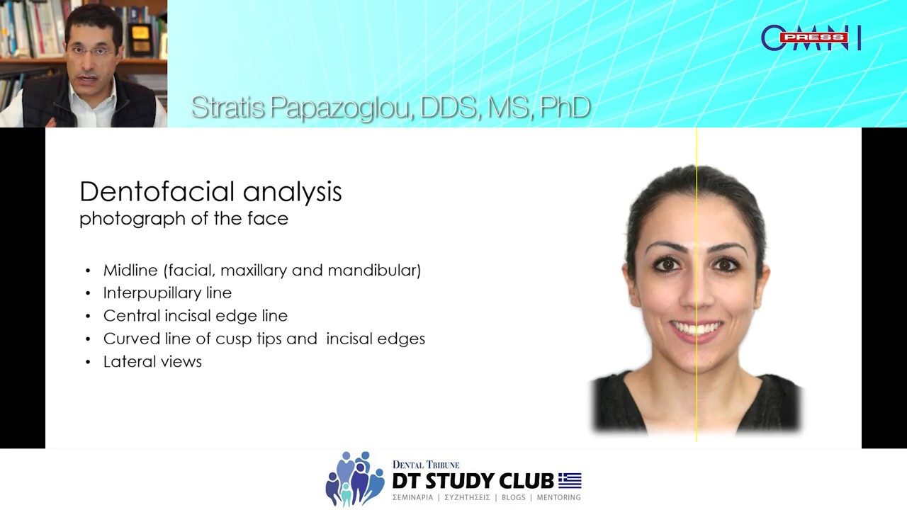 Smile improvent Simplification of esthetic analysis and restoration with laminate veneer