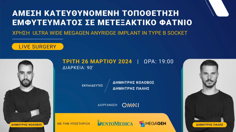 Άμεση κατευθυνόμενη τοποθέτηση εμφυτεύματος σε μετεξακτικό φατνίο. Χρήση Ultra wide Megagen Anyridge Implant in Type B socket.