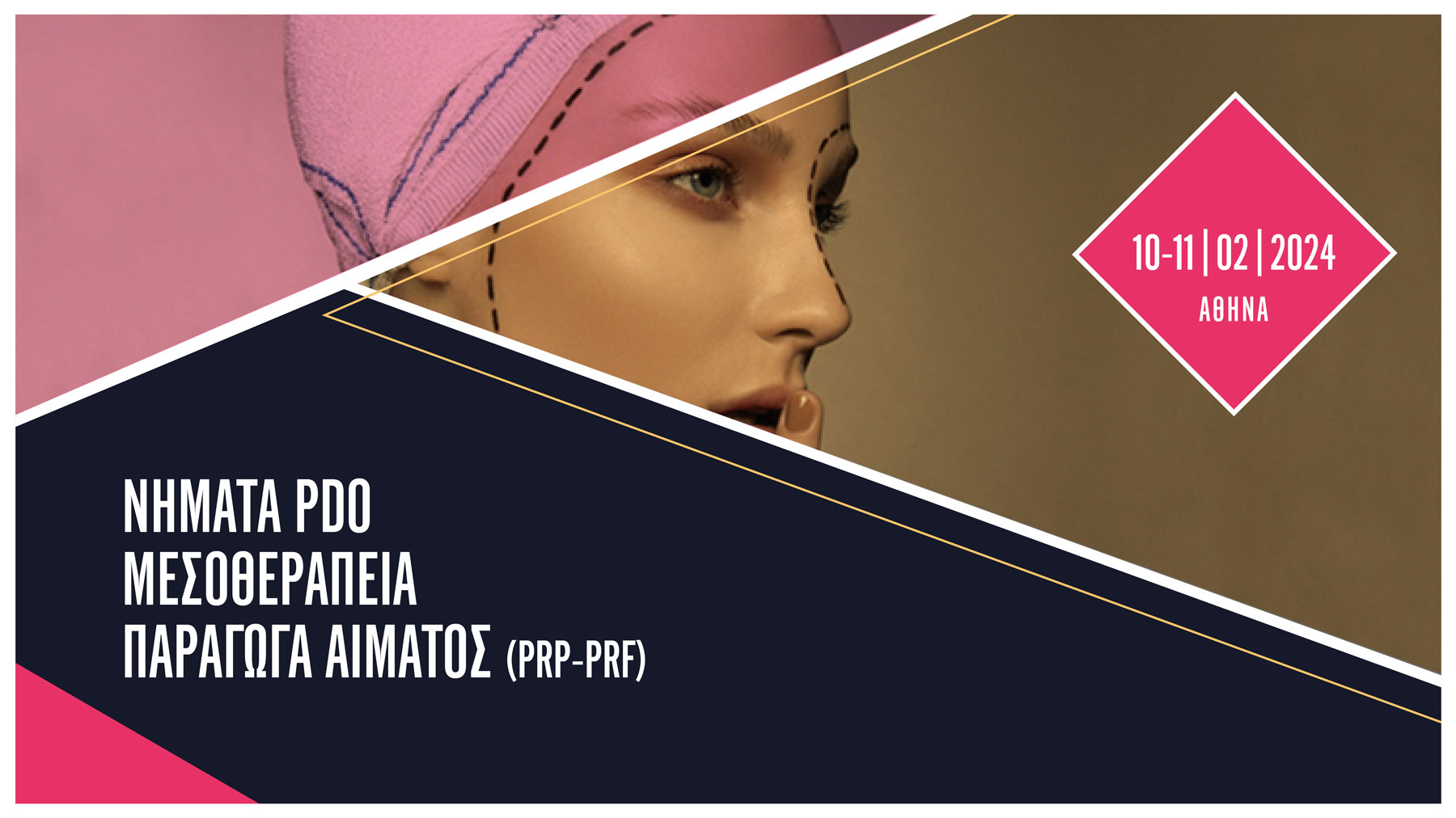 2ήμερο σεμινάριο Νήματα PDO / Μεσοθεραπεία / Παράγωγα αίματος PRP-PRF (Αθήνα)