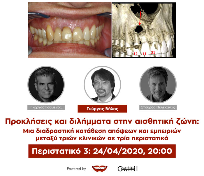 Προκλήσεις και διλήμματα στην αισθητική ζώνη